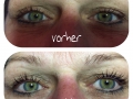 wimpern-lash-lifting-vorher-nachher